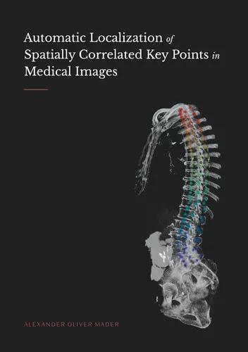 Automatic Localization of Spatially Correlated Key Points in Medical Images