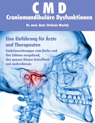 CMD - Craniomandibuläre Dysfunktionen