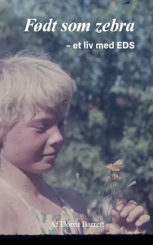 Født som Zebra