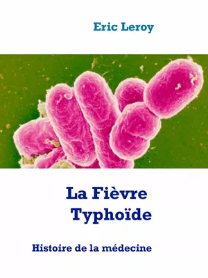 La Fièvre Typhoïde
