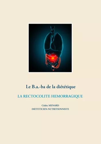 Le B.a.-ba de la diététique de la rectocolite hémorragique