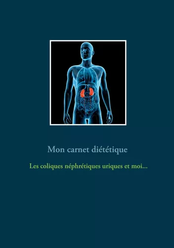 Mon carnet diététique : les coliques néphrétiques uriques et moi...
