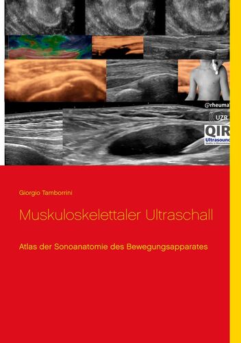 Muskuloskelettaler Ultraschall