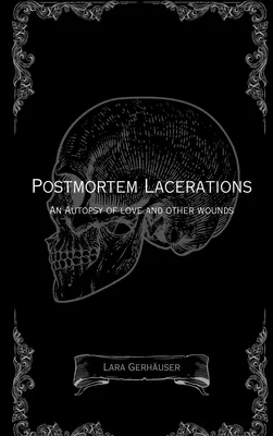 Postmortem Lacerations