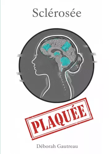 Sclérosée Plaquée