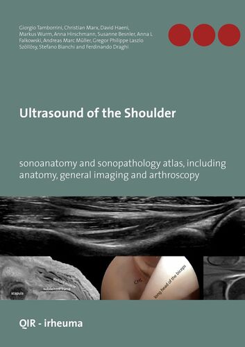 Ultrasound of the Shoulder