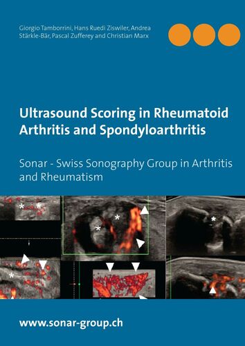 Ultrasound Scoring in Rheumatoid Arthritis and Spondyloarthritis